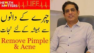 How To Remove Pimples Overnight | Acne Treatment | Dr Kamran Qureshi