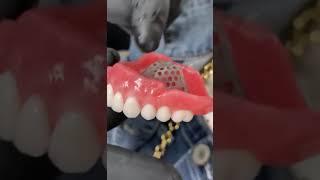 One Day Smile Transformation