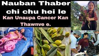 Cancer Damdawi NAUBAN thaber chi Kan Unaupa Cencer kan thawn: Heihi Atha ber chi angkha a ni e