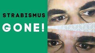 Success Getting Rid Of Strabismus