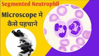 s shape neutrophil