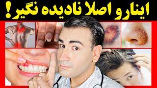 15 نشانه کمبود ویتامین و مواد معدنی که اصلا نباید نادیده بگیری! برای هرکدام باید چی بخوری؟