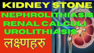 Kidney stone I renal calculi I Nephrolithiasis I Urolithiasis I sign & symptoms