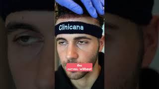 Hair Transplant Without Shaving?? #hairlosstreatment #hairtransplant #mensgrooming #mensgrooming