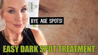 Easy Dark Spot Treatment - Melasyl -  Kiehl's Auto Tone #hyperpigmentation