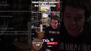 Twitch Streamer removes a live Tick from his hair! #Shorts