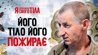 Неизвестная болезнь заберет жизнь?  – Я соромлюсь свого тіла | ЛЕЧЕНИЕ | ДОКАЗАТЕЛЬНАЯ МЕДИЦИНА