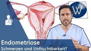 Was ist Endometriose? Das Chamäleon der Gynäkologie - Alles über Ursachen, Symptome & Therapie