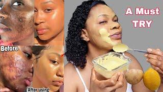 My face is smooth &bright after using this mask, You will be happy that you tried it #skincare #diy