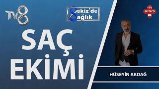 Saç Ekimi Nedir? | Hüseyin Akdağ | 8'de Sağlık