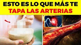 ¡ALERTA! Este alimento común es el que MÁS TE SUBE EL COLESTEROL y nadie te lo dice