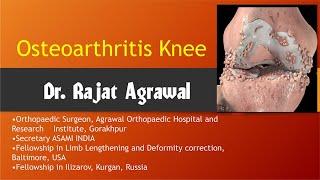 GPA 8th CME "Topic : Osteoarthritis Knee" - Dr. Rajat Agrawal, Orthopaedic Surgeon.