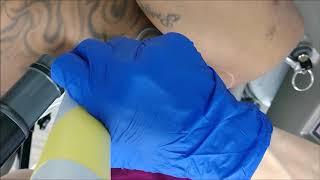 Arm tattoo detailed: Laser Tattoo Removal Fairfax, Arlington, Alexandria, Springfield, Virginia