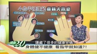 指甲隱藏疾病大訊息！身體健不健康 看指甲就知道 健康2.0 20160827(完整版)