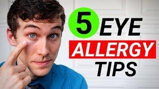 How to Get Rid of Itchy Eyes - 5 Tips for Itchy Eyes Allergy Relief