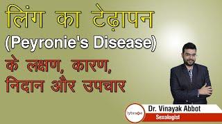 लिंग का टेढ़ापन (Peyronie's Disease) के लक्षण, कारण, निदान और उपचार | Dr. Vinayak Abbot | Lybrate