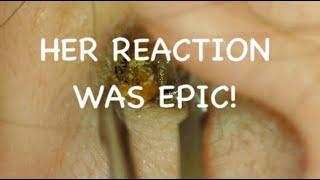 EAR WAX REMOVAL : HER REACTION WAS EPIC : 4K/HD