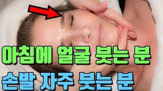 한번만 먹어도 붓기를 쫙 빼주는 이 것! (아침에 얼굴이 붓는 분, 손발이 자주 붓는 분 종아리가 아프신 분)