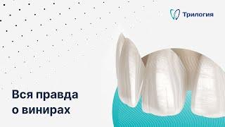 Керамические виниры E-max - подготовка и установка