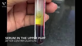 How is serum extracted from the blood sample?