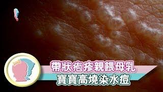 《媽媽罹患帶狀疱疹親餵母乳 寶寶高燒染水痘》【育兒幫寶典】《哺乳大全》│寶貝幫TV