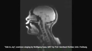 Beethoven "Ode to Joy" with Overtone Singing (MRI) - see what happens inside the mouth