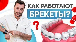 Как работают брекеты и почему так медленно? Современная ортодонтия