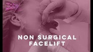 Woman has non-surgical facelift for the first time