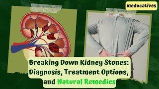 Breaking Down Kidney Stones Diagnosis, Treatment Options, and Natural Remedies