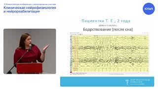 Н.Е. Кваскова. Эволюция электроэнцефалографической картины у пациентов с GLUT1. Случаи из практики