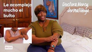 El bulto es tan grande que al levantarse se le duerme el brazo | Doctora Mercy, dermatóloga