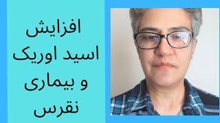 Hyperuricemia,  gout disease  بیماری نقرس و افزایش اسید اوریک  علائم،  علل،  تشخیص و درمان