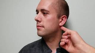 Chvostek's Sign of Hypocalcemia: Facial Nerve Tapping