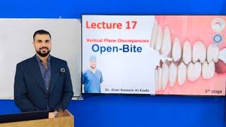 Vertical plane discrepancy: Open-bite malocclusion lec.17 stage.5