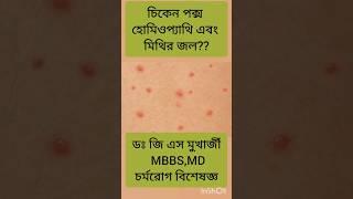 Chicken pox | #dermatologist #shorts #skinspecialist #doctor #health #bangla #skincareroutine