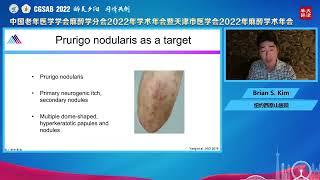 Dr. Brian Kim: Neuroimmune Regulation of Itch, Tianjin China 8_22