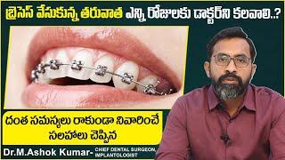 Precautions Should be Taken With Dental Braces || Orthodontic Treatment || Eledent Dental Hospitals