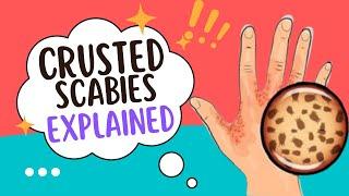 CRUSTED SCABIES EXPLAINED FAST! CAUSE AND TREATMENT