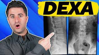 3 facts you MUST KNOW about your DEXA scan