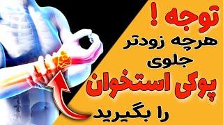 پوکی استخوان چیه | بهترین راهکارها برای جلوگیری از پوکی استخوان