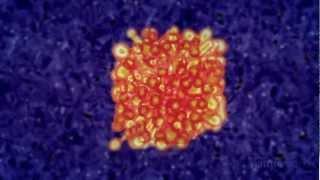 Immunotherapy: Boosting the immune system to fight cancer