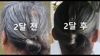 2달 후 머리숱이 많아지고 흰머리가 검은 머리로 변했습니다. 초주파발마사지 2달 사용 후기.