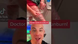 Derm reacts to SEVERE sunburn! #dermreacts #doctorreacts #badsunburn