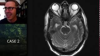 Isolation tutorial: Neuroradiology with Frank Gaillard