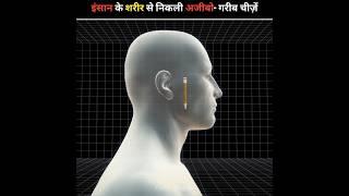 Strangest Things Found In Human BodyFact Spiral#facts