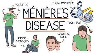 Understanding Ménière’s Disease