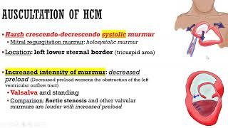 Hypertrophic Cardiomy - PA-SOS