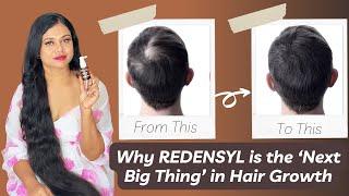 Why REDENSYL is the Next Big Thing in Hair Growth Ft. Soulflower Rosemary Redensyl Hair Growth Serum