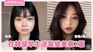 在韓留學生逆襲變美第二篇-面部吸脂｜韓國必嫵整形醫院View Plastic Surgery