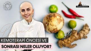 Kemoterapi Öncesi ve Sonrası Neler Oluyor?